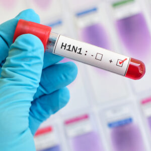 【甲型流感】流感季節觀念已過時？了解症狀、潛伏期、傳染力及死亡率