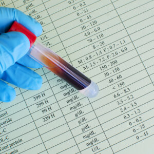 膽固醇高買唔買到保險？拆解核保標準