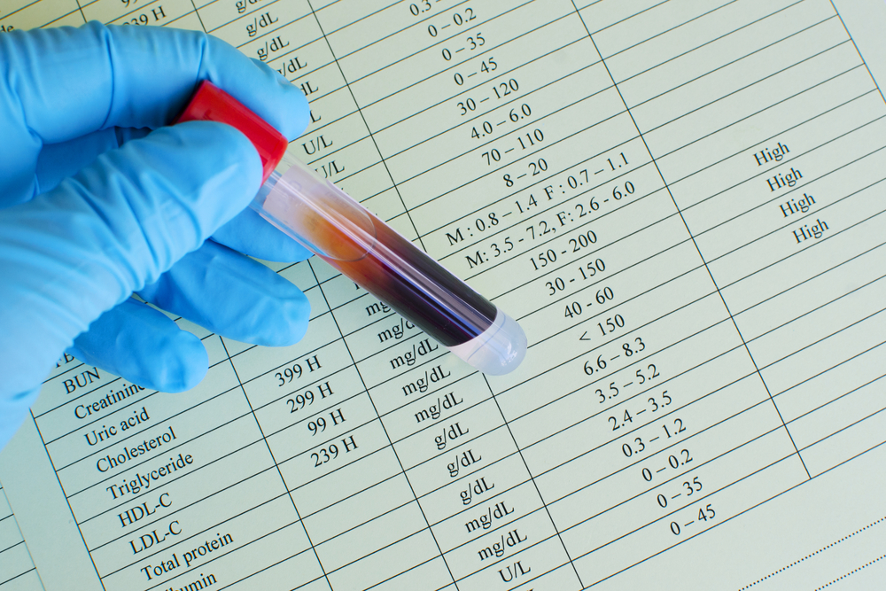 膽固醇高買唔買到保險？拆解核保標準