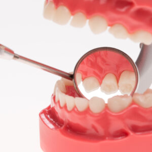 深水埗牙醫邊個好？牙科診所名單整合(附營業時間+地址+電話)