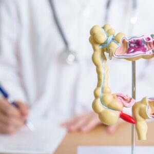 【大腸癌】一圖了解發病年齡分佈！幾多歲開始要小心？