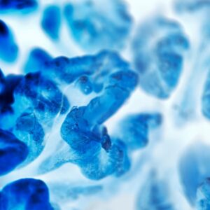 良性腫瘤是什麼？它會否演變成惡性腫瘤？