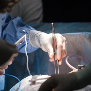 【腫瘤切除手術】了解過程、費用與時間