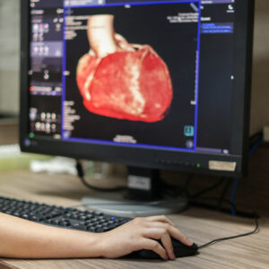 心臟/心血管電腦掃描2025：用處、檢查過程與收費