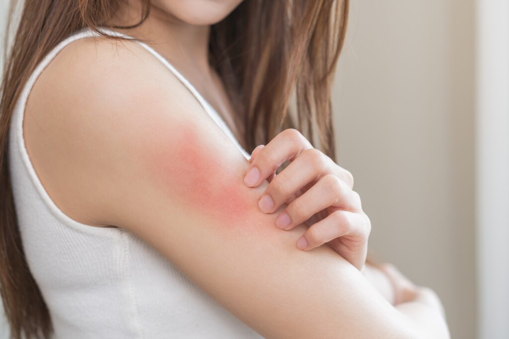 【甲型鏈球菌】食人菌死亡率高達 3 成？成因、症狀、治療及預防方法