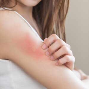 【甲型鏈球菌】食人菌死亡率高達 3 成？成因、症狀、治療及預防方法