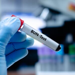 【尿素】正常值多少？過高對身體有甚麼影響？（附相關檢查費用）