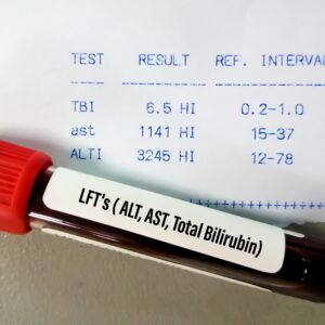 【總膽紅素】正常值幾多？偏高會導致甚麼疾病？（附相關檢查費用）