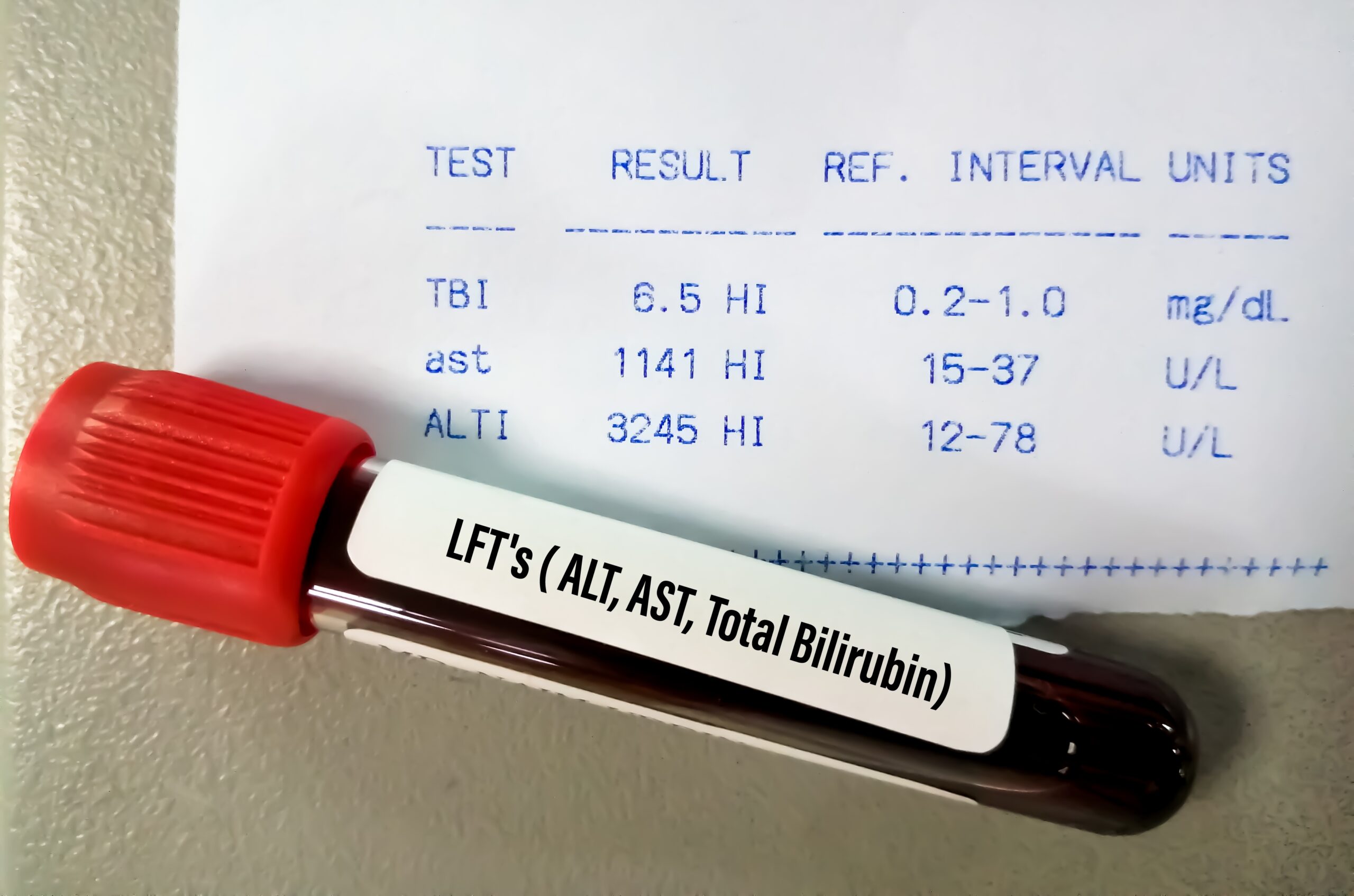 Bilirubin Levels: Normal Values, High Causes, and Tests | Bowtie
