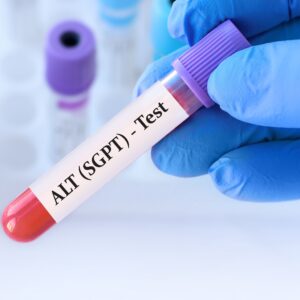 【谷丙轉氨酶】正常值幾多？指數過高會點？（附谷丙轉氨酶相關檢查收費）