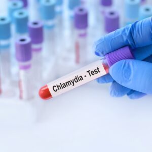 【衣原體】感染成因、途徑及病徵是甚麼？會復發嗎？（附衣原體檢驗價錢）