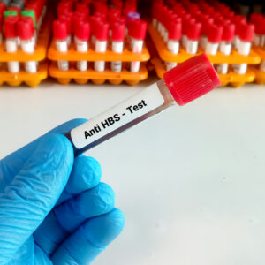 【乙型肝炎表面抗體】陽性代表咩？數值幾多先係正常？（附相關檢查收費）