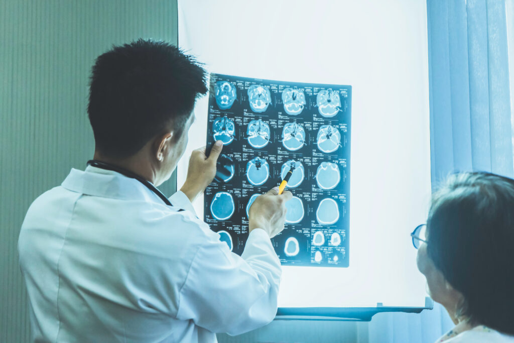 【腦部掃描】CT Scan及MRI有咩分別？（附私家醫院及診所收費）