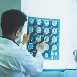 【腦部掃描】CT Scan及MRI有咩分別？（附私家醫院及診所收費）