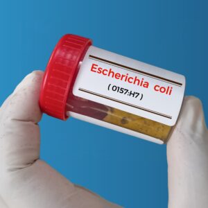 【產志賀毒素大腸桿菌】出現感染群組！了解傳播途徑、症狀、治療及預防方法