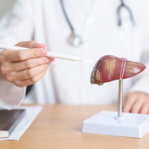 組織碎化技術（Histotripsy）是甚麼？香港哪些醫院有提供相關肝癌治療？