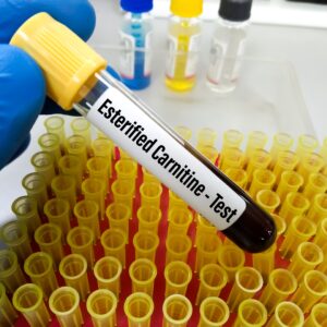 【原發性肉鹼缺乏症】了解症狀、成因、診斷及治療方法