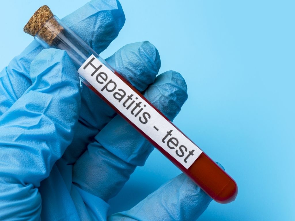 Can Patients With Hepatitis B Insure Successfully?