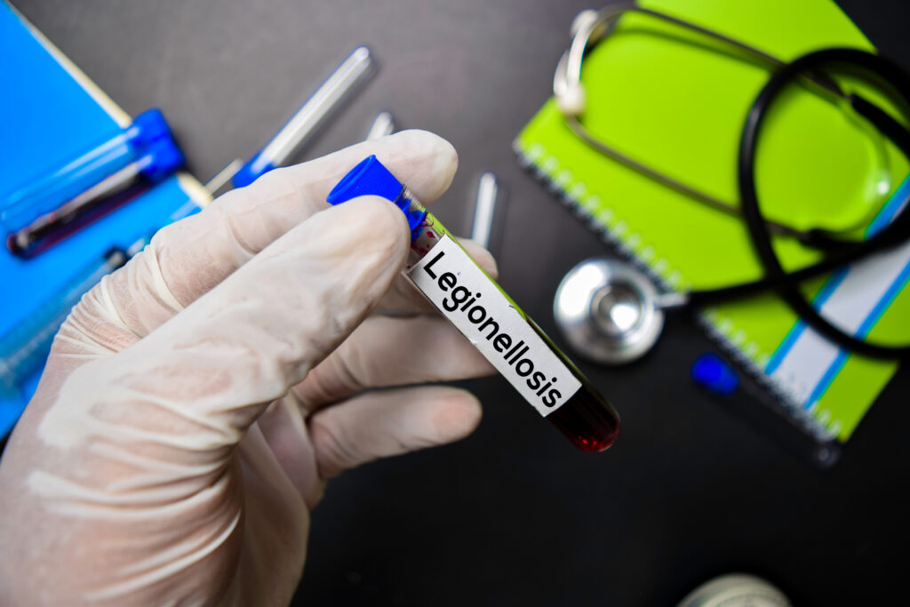 【退伍軍人病】會經水塔傳播？成因、症狀、感染途徑、治療及預防方法