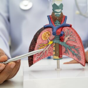 【肺結核】肺癆成因、症狀、感染途徑、治療及預防方法