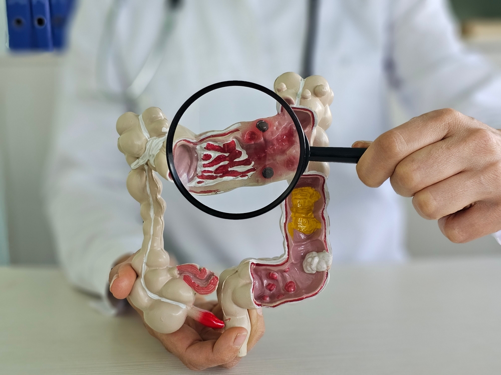 【大腸癌篩查計劃醫生名單​】診所名稱、地址及電話一覽