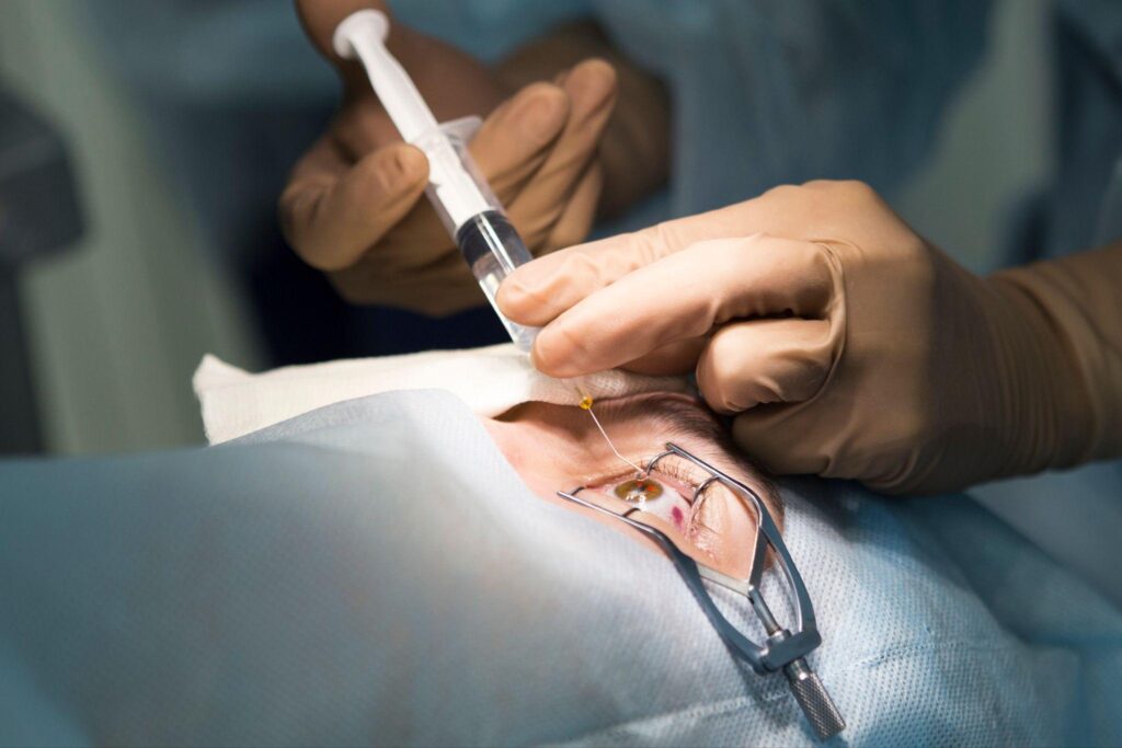 通波仔費用幾錢？自願醫保或其他保險包唔包？