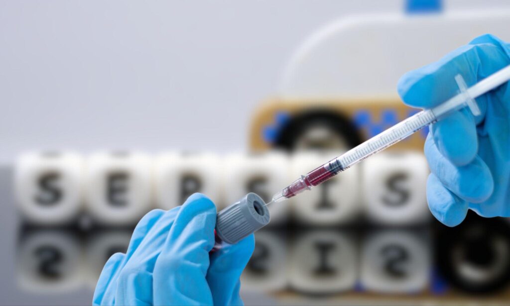 敗血病檢查、治療費用幾錢？自願醫保包唔包？