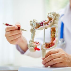 結腸切除手術費用幾錢？自願醫保包唔包？