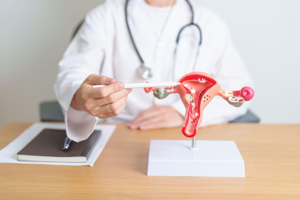 卵巢切除術費用幾錢？自願醫保包唔包？