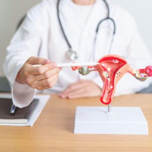 卵巢切除術費用幾錢？自願醫保包唔包？