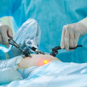 多汗症/手汗汗腺手術費用幾錢？自願醫保包唔包？