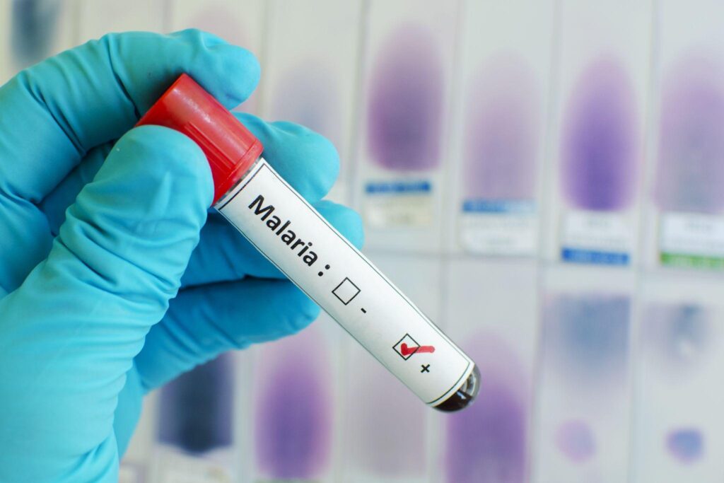 瘧疾檢查、治療費用幾錢？自願醫保包唔包？