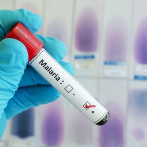 瘧疾檢查、治療費用幾錢？自願醫保包唔包？