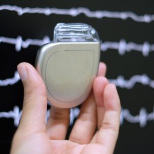 除顫器植入術（ICD）費用幾錢？自願醫保包唔包？