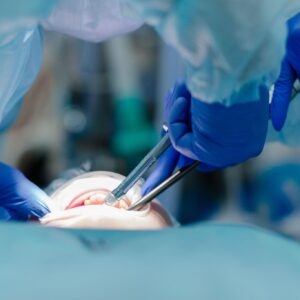 頷下腺手術費用幾錢？自願醫保包唔包？