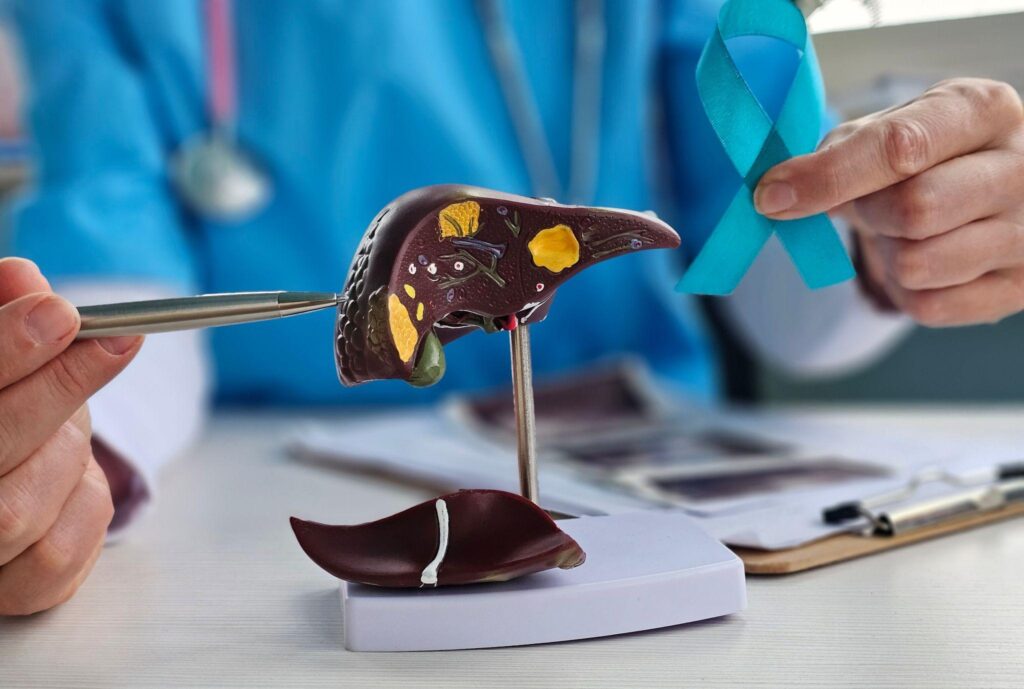 肝臟腫瘤射頻消融術費用幾錢？自願醫保包唔包？