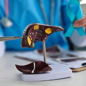 肝臟腫瘤射頻消融術費用幾錢？自願醫保包唔包？