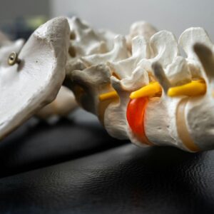 腰椎穿刺費用幾錢？自願醫保包唔包？