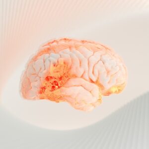 引流腦積水手術費用幾錢？自願醫保包唔包？