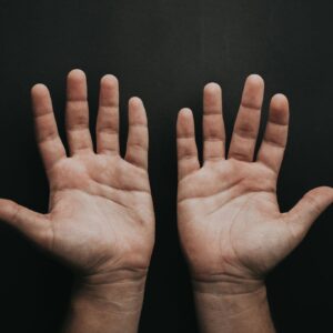 尺神經移位術費用幾錢？自願醫保包唔包？