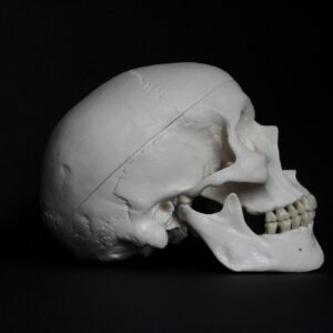 顱骨開孔手術費用幾錢？自願醫保包唔包？